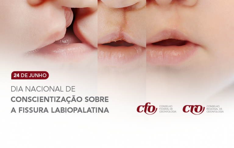 Dia Nacional de Conscientização sobre a Fissura Labiopalatina