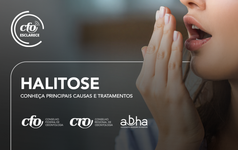 Halitose: Aproximadamente 90% das causas estão na cavidade bucal